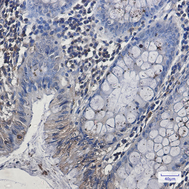 Rabbit Monoclonal Antibody to EHD1