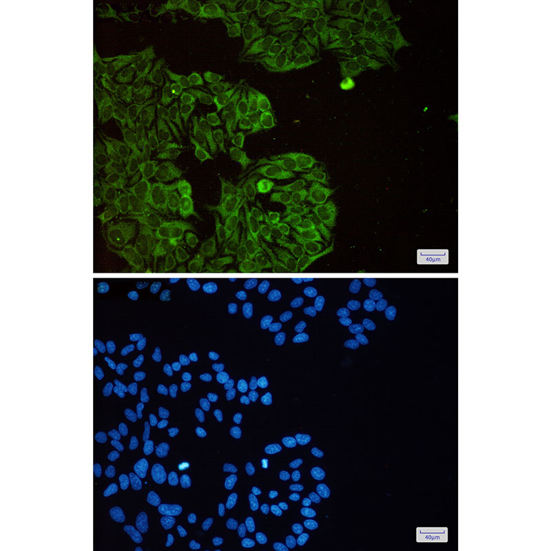 Rabbit Monoclonal Antibody to eIF3B