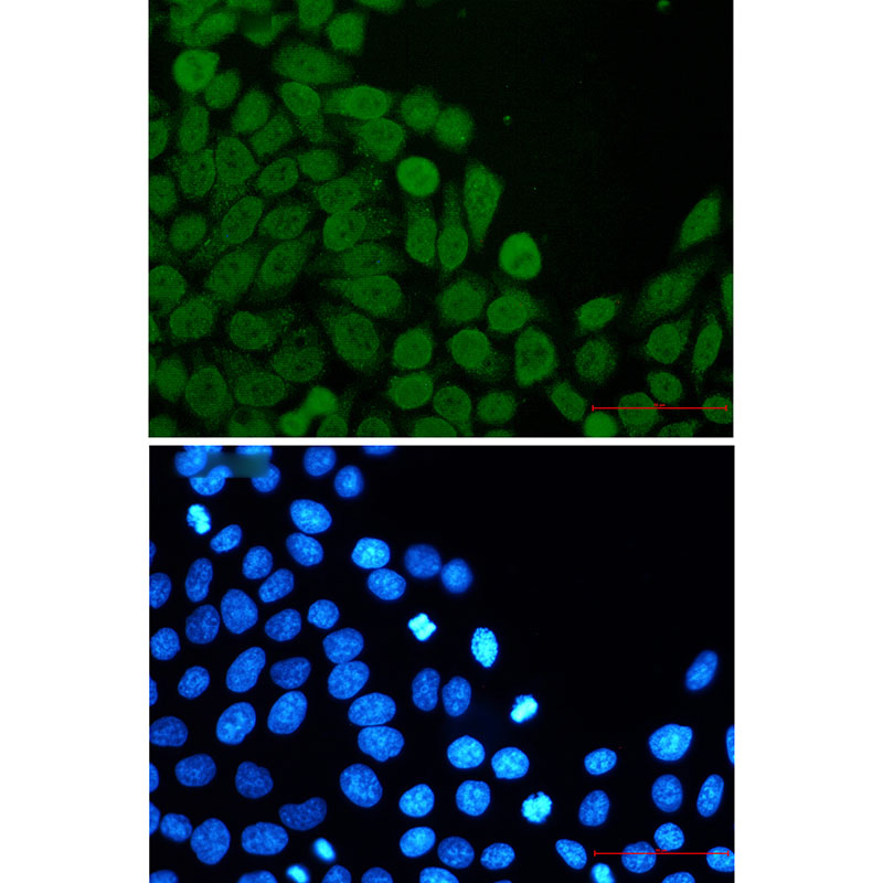 Rabbit Monoclonal Antibody to eIF4A3