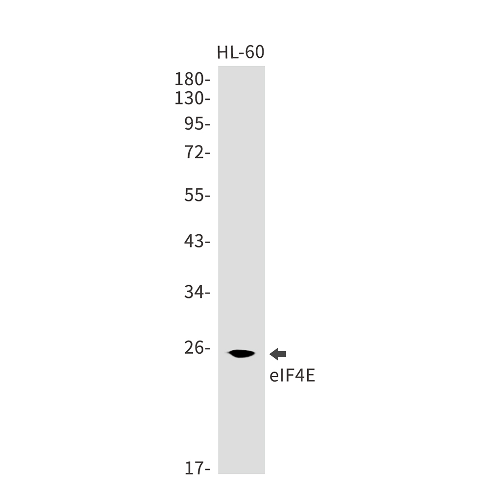 eIF4E