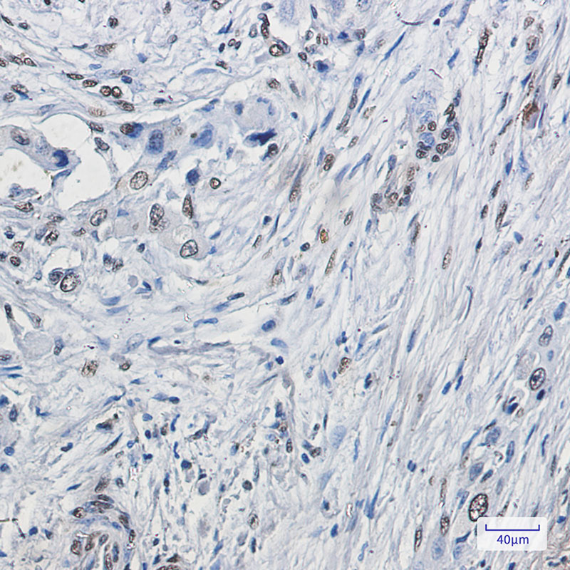 Rabbit Monoclonal Antibody to ELK1