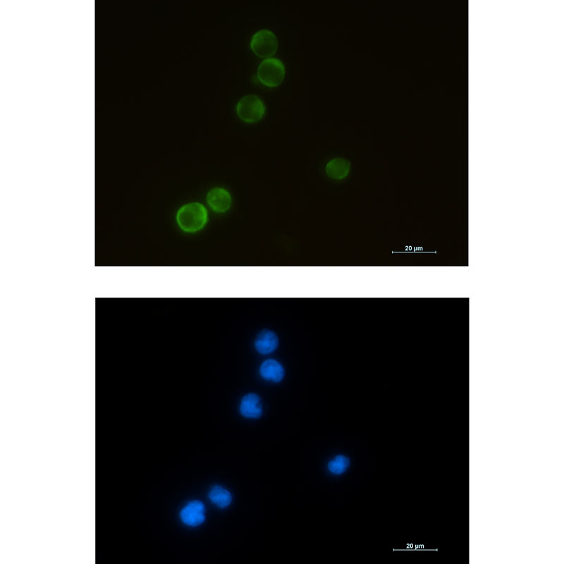 Rabbit Monoclonal Antibody to ELMO1