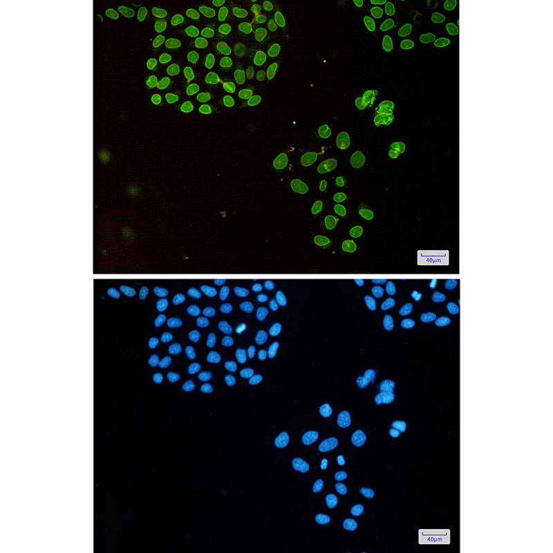 Rabbit Monoclonal Antibody to Emerin