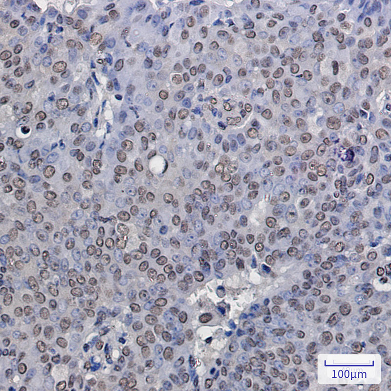 Rabbit Monoclonal Antibody to ENT2