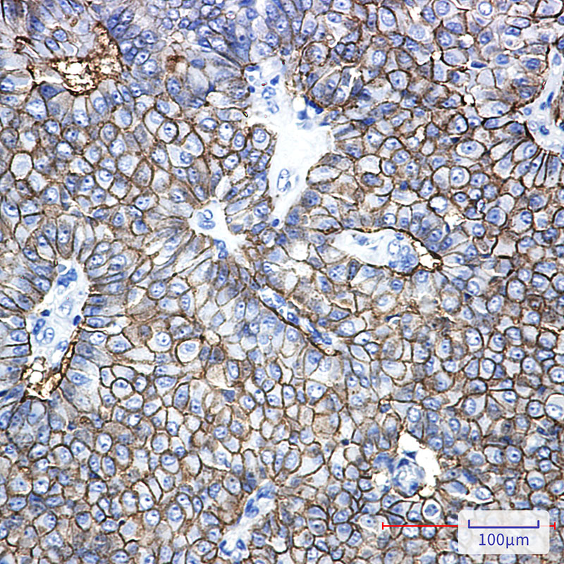 Rabbit Monoclonal Antibody to EpCAM