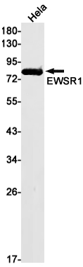EWSR1
