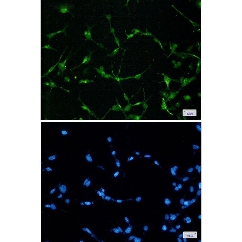 Rabbit Monoclonal Antibody to EWSR1