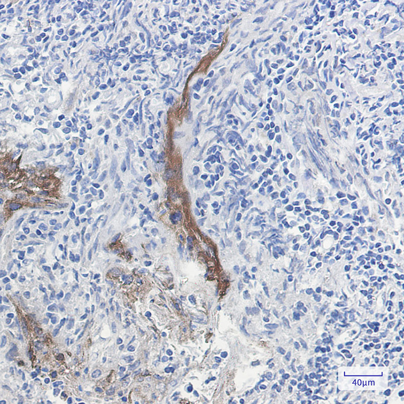 Rabbit Monoclonal Antibody to Extracellular Matrix Protein 1