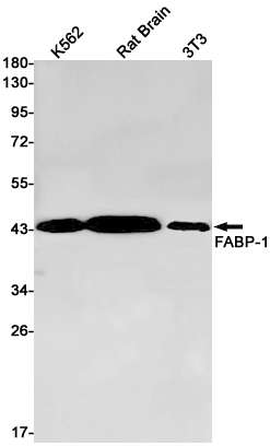 Aspartate Aminotransferase