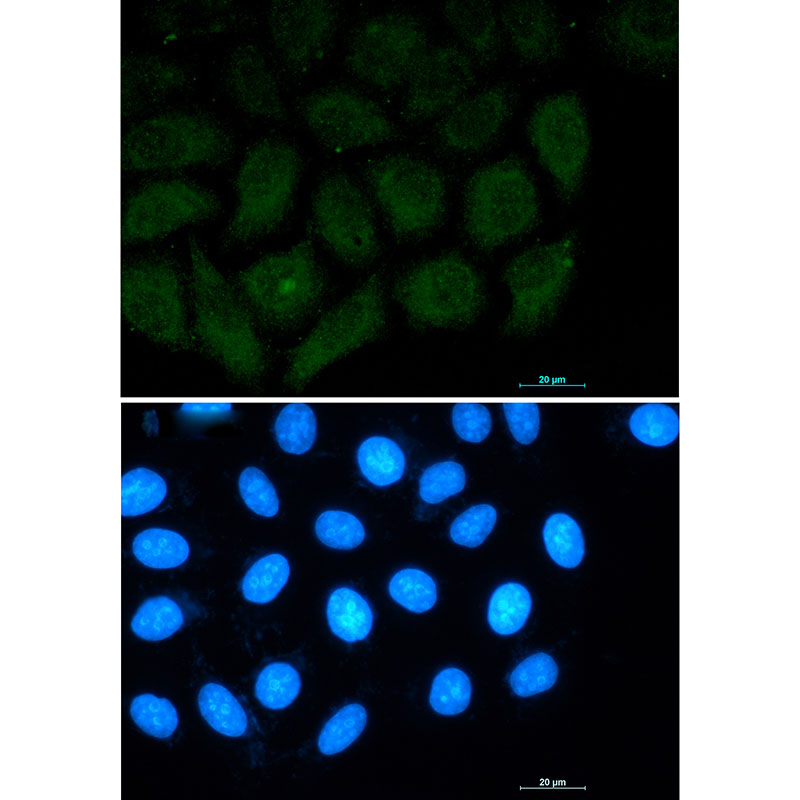 Rabbit Monoclonal Antibody to FAK