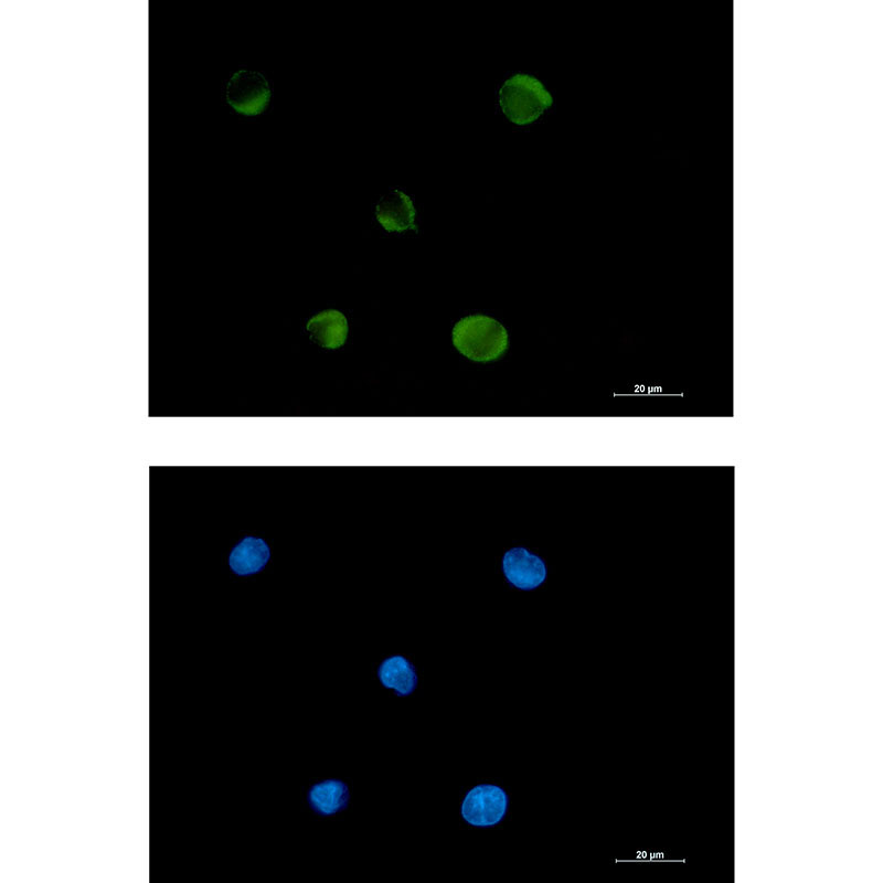 Fad One Rabbit Monoclonal Antibody to FADS1_FADS1-远泰生物抗体定制