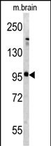 Metabotropic Glutamate Receptor 5 (GPRC1E) (C-term T1003)
