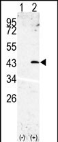 SPPL3 (N-term)