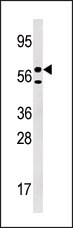 URKL1 (N-term)