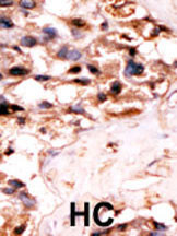Rabbit Polyclonal Antibody to URKL1 (N-term)