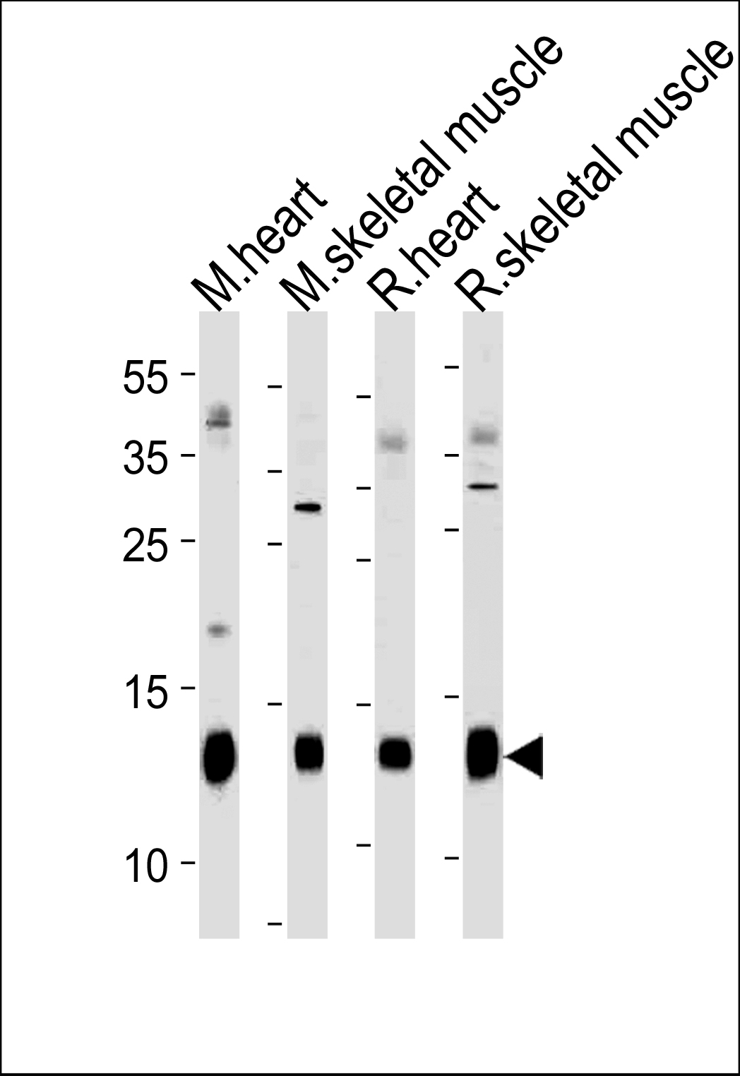Mouse PLM (N-term)