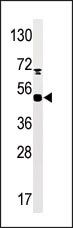 Phospho-MAPKAPK5(S93)