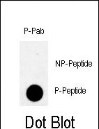 Phospho-MYT1(T495)
