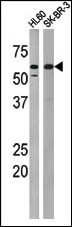 Rabbit Polyclonal Antibody to Phospho-MYT1(T495)