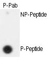 Phospho-SEPARIN(S1126)