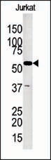 Glycerol kinase (GPK2)