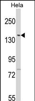 LMTK2 (N-term)