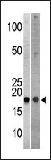 NCBP2 (N-term)
