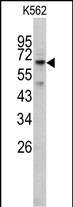 RIOK1 (N-term)