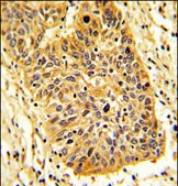 Rabbit Polyclonal Antibody to RIOK1 (N-term)