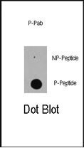 Phospho-EP300(S89)