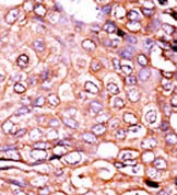 Rabbit Polyclonal Antibody to Phospho-EP300(S89)