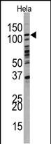 PI3KC3 (N-term G24)