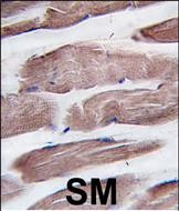 Rabbit Polyclonal Antibody to PI3KC3 (N-term G24)