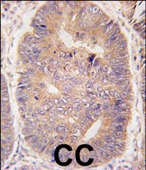 Rabbit Polyclonal Antibody to TASP1