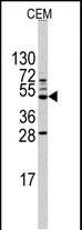Rabbit Polyclonal Antibody to HS2ST1