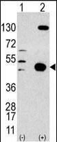 Rabbit Polyclonal Antibody to HS2ST1