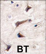 Rabbit Polyclonal Antibody to HS2ST1