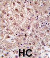 Rabbit Polyclonal Antibody to PSMA5 (N-term)