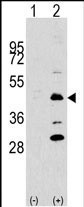 DPF2 (N-term)
