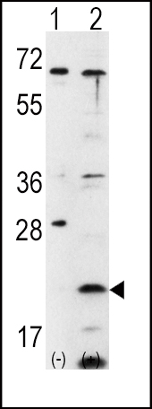 Rabbit Polyclonal Antibody to FXN
