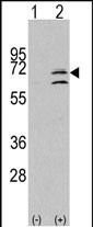 MAPK15 (N-term)