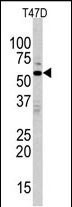 Rabbit Polyclonal Antibody to MAPK15 (N-term)