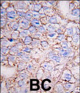 Rabbit Polyclonal Antibody to MAPK15 (N-term)