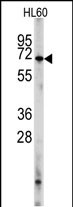 PDE8A (L572)