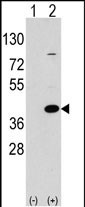 EPM2A