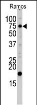 UVRAG (C-term L555)