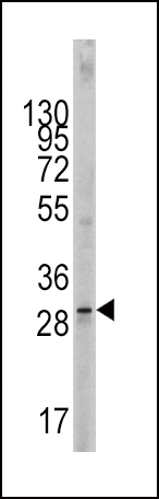 SCF (KITLG)