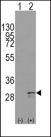 Rabbit Polyclonal Antibody to SCF (KITLG)
