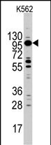 Myosin 1C (MYO1C)