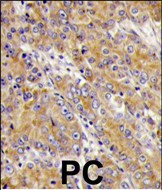 Rabbit Polyclonal Antibody to Myosin 1C (MYO1C)